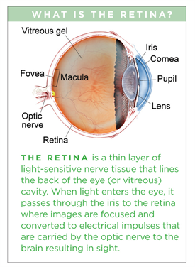 Retinal Tear vs. Retinal Detachment - Monterey, CA - Salinas